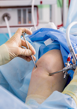 knee arthroscopy